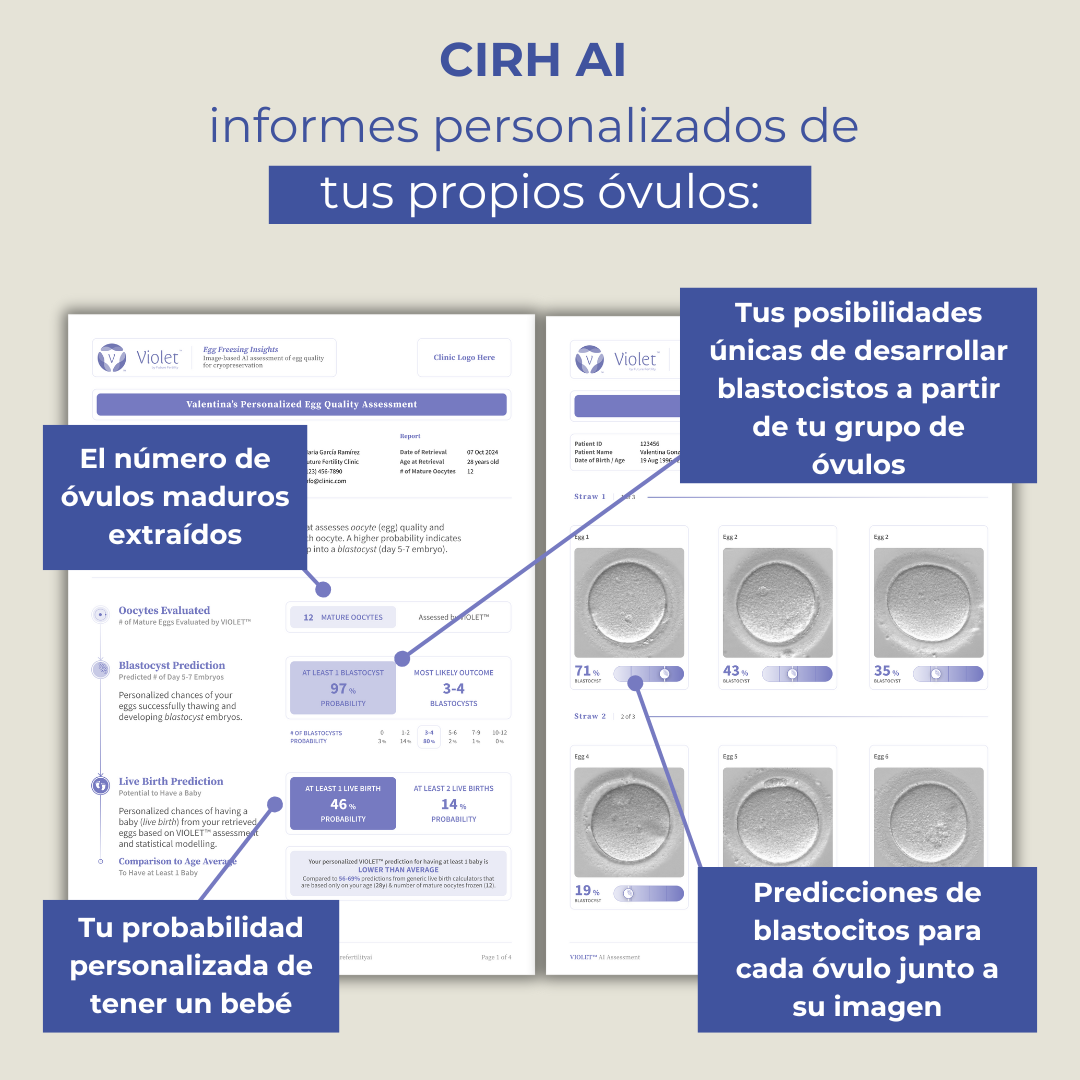 CIRH AI ES